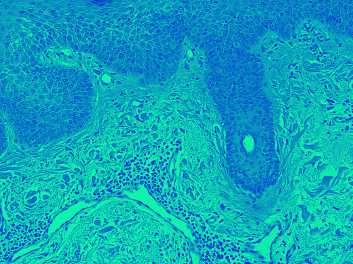 Histological Image of Fibrotic Tissue - Allinky Biopharma